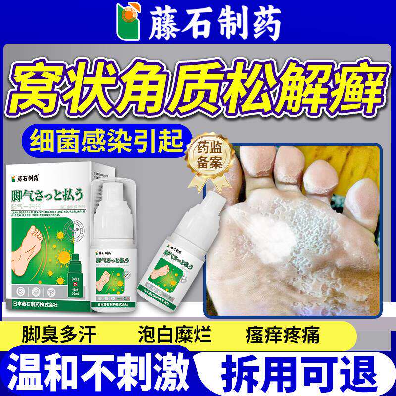窝状角质松解懈症真菌感染