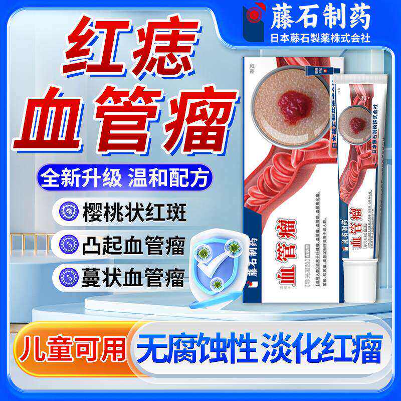 血管瘤痣搭普萘洛尔软膏去