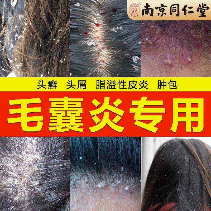 氨基酸洗发水防脱育中药增