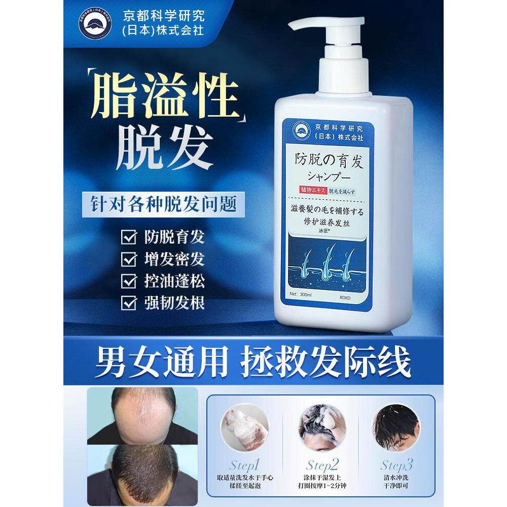 脂溢性皮炎洗发水脱控油头