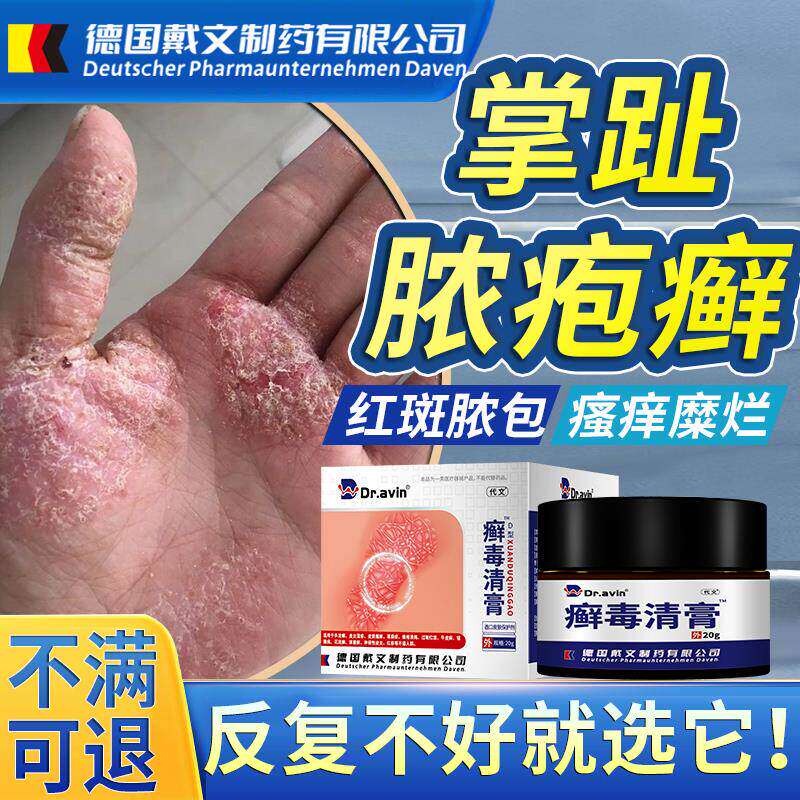 掌趾脓疱病症专用角化手脚