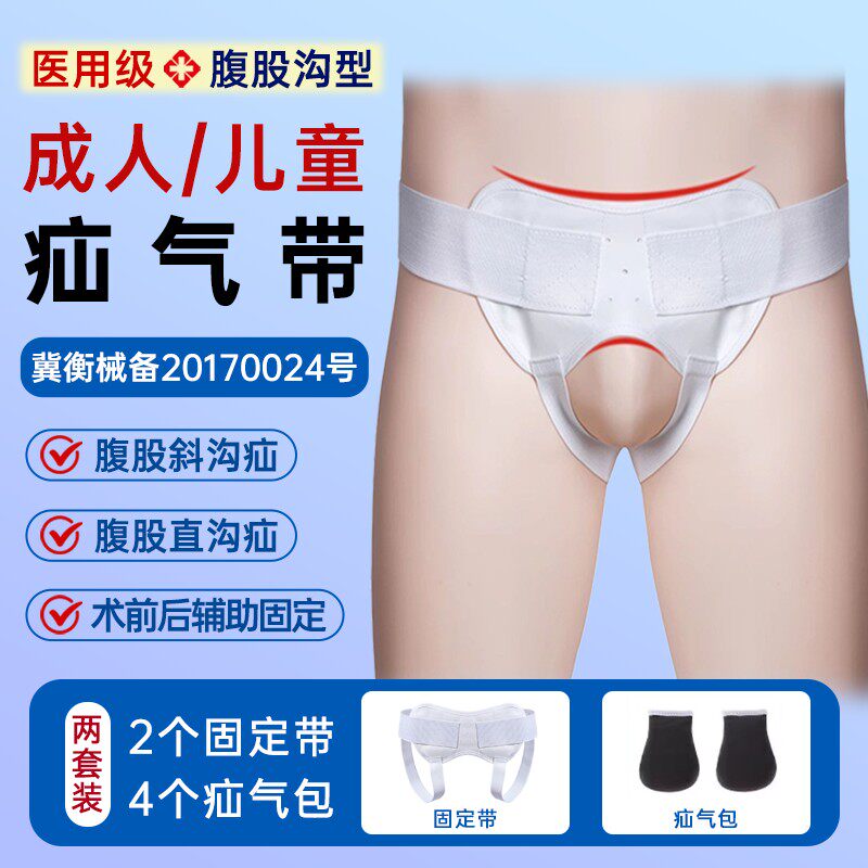 婴幼儿脐疝气治疗带腹股沟