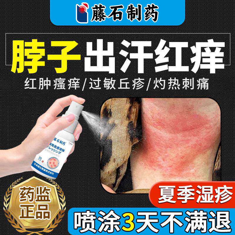 夏天脖子出汗红痒皮肤过敏