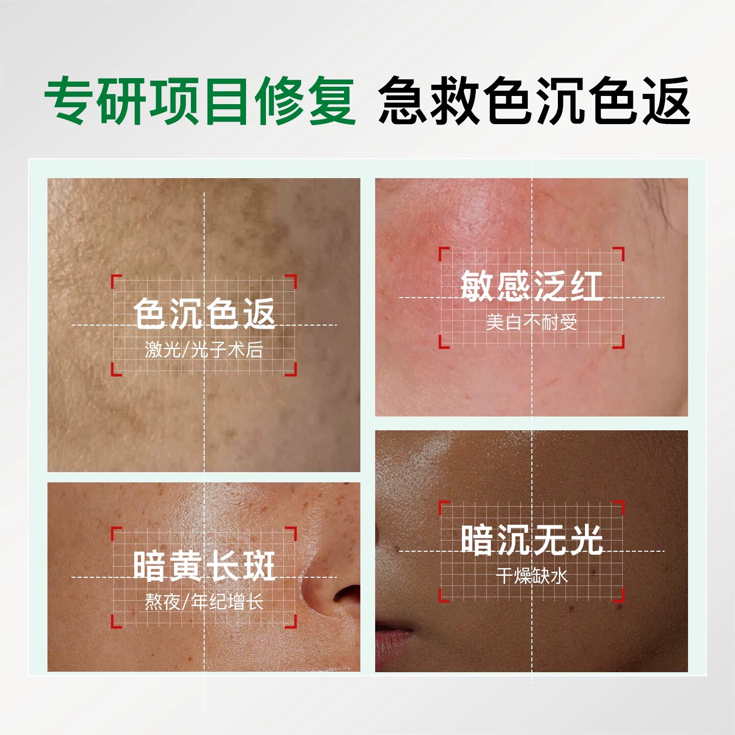 氨甲环酸精华液乳膏美白祛斑霜淡黄褐斑分解黑色素提亮女官方正品