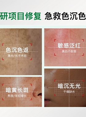 项目修复丨氨甲环酸乳霜淡色沉返