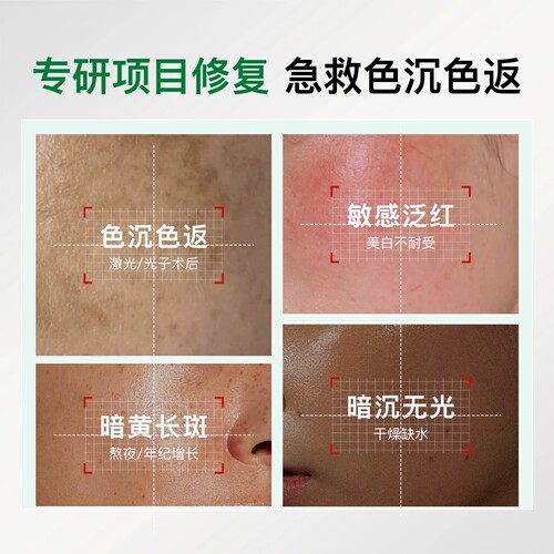 项目修复丨氨甲环酸乳霜淡色沉返