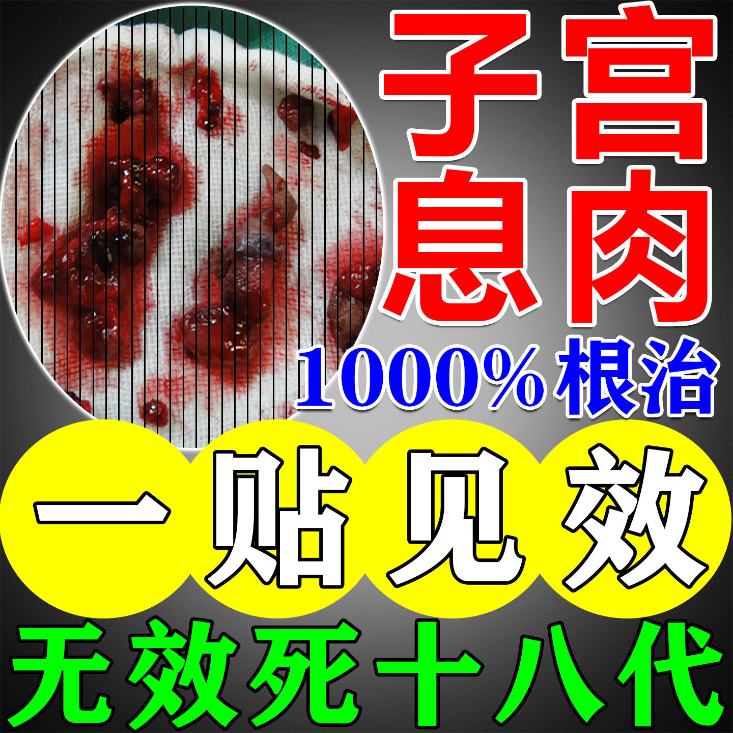 膜息肉中非药贴肌瘤卵巢囊肿增厚热敷包下垂异位症调理