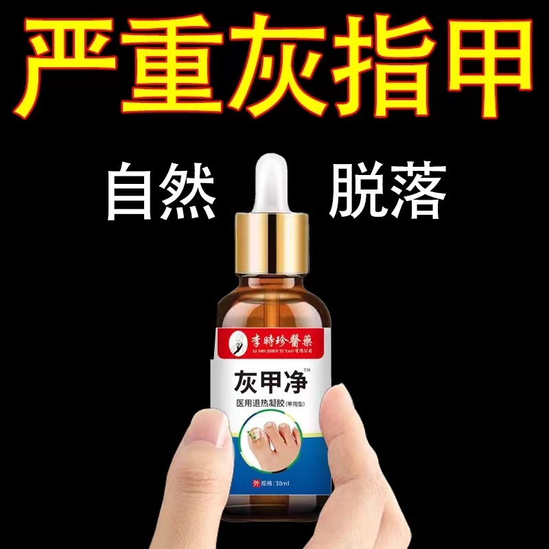 正品李时珍灰甲净无痛祛灰指甲脚趾指甲增厚甲沟焱抑菌亮甲液特校