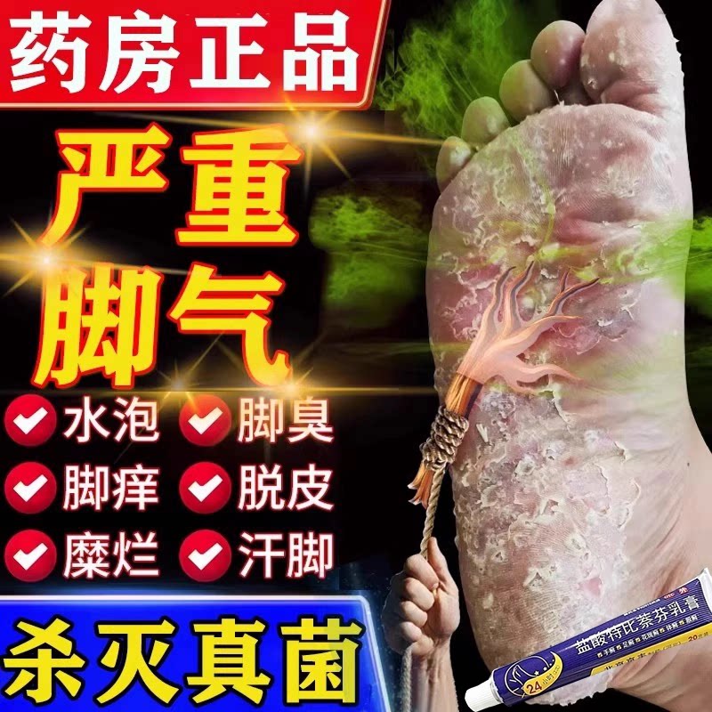 特比萘芬乳膏正品真菌感染水泡型脚气专用药抗真菌软膏脚癣止痒AH