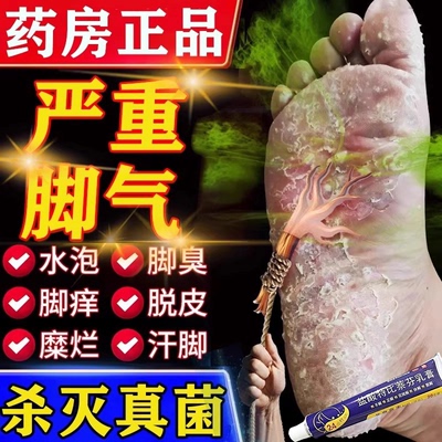特比萘芬乳膏正品真菌感染水泡型脚气专用药抗真菌软膏脚癣止痒AH