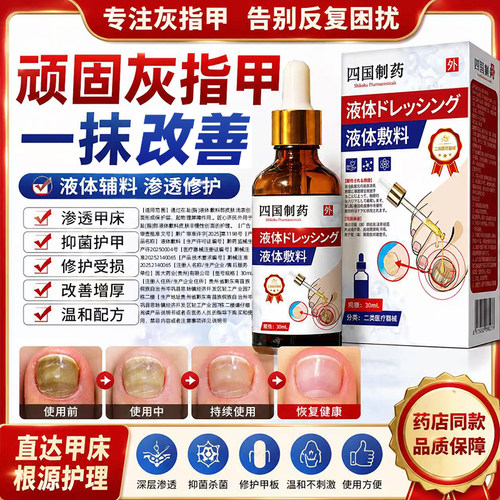 专治疗去灰指甲变黄发厚脱甲发黄抑菌液抗真菌日本趾膏甲沟炎喷雾