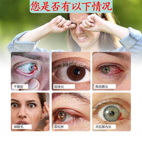 极速眼睛除螨虫洗眼n液眼部清洁止痒叶黄素眼干涩发痒充血过敏驱