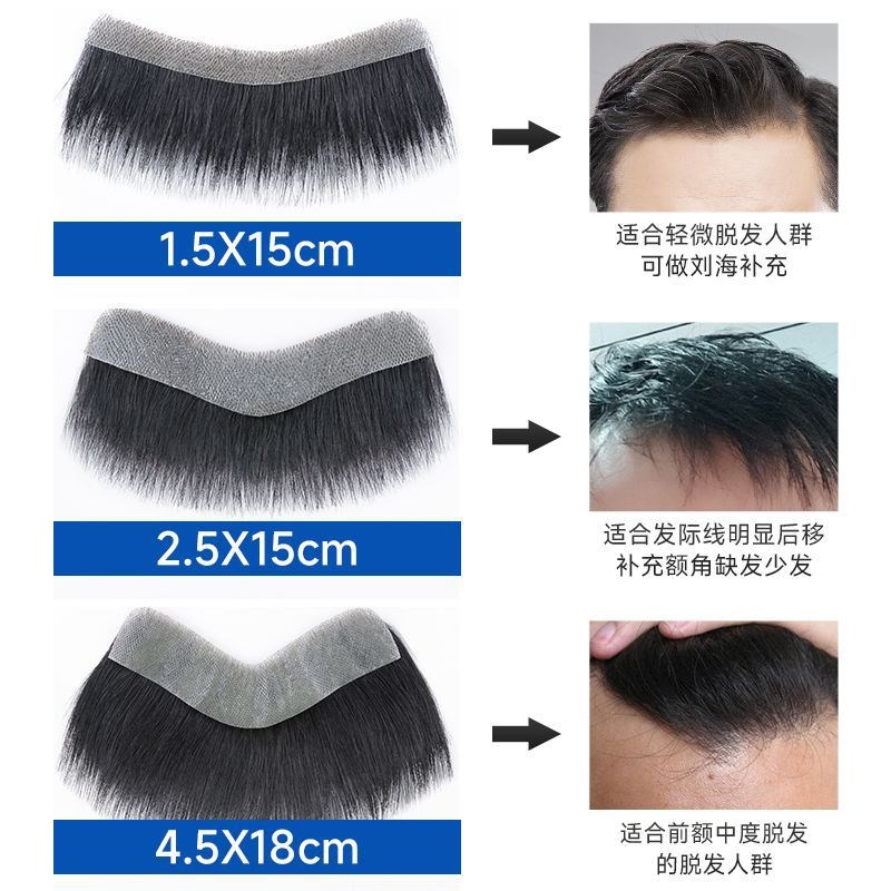 男士前额假发片发际线假发贴刘海m型假发男短发真人发丝假发贴片