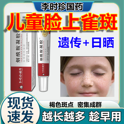 【李时珍国药】专攻儿童雀斑