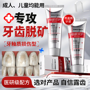 牙齿脱矿白斑钙化修复含氟儿童补矿再矿化专用牙釉质损伤牙膏u9