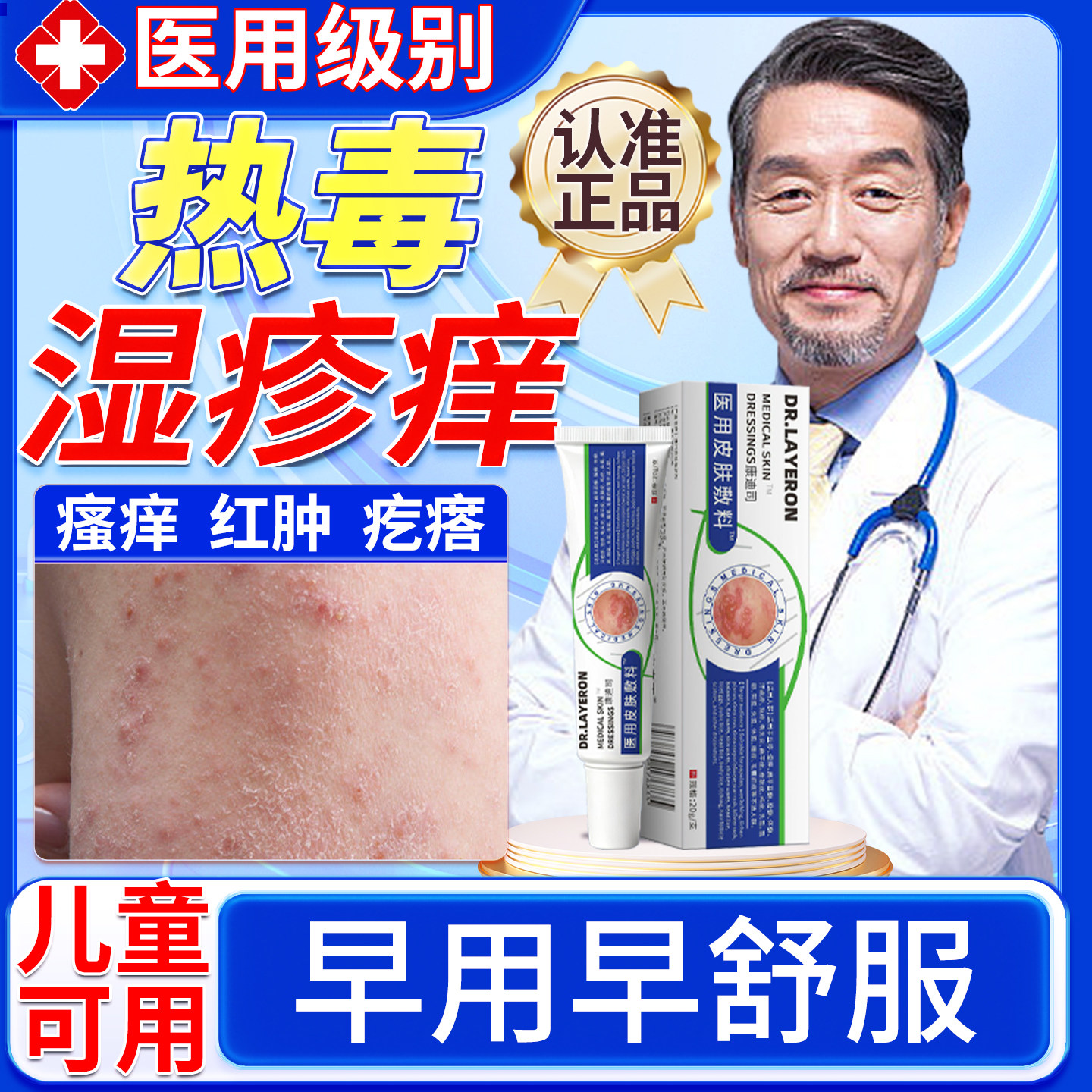 热毒湿疹止痒膏皮肤一热就痒瘙痒专用除红斑皮炎湿疹红肿感染喷u9