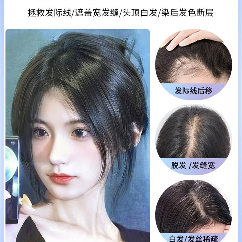 高颅顶递针假发女头顶增发量蓬松前额刘海真发全真人发隐形补发片