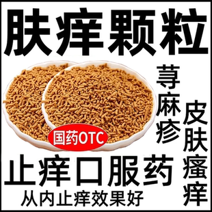 正品肤痒颗粒正品治疗荨麻疹的特痒效药荨麻疹过敏止痒断皮肤瘙痒