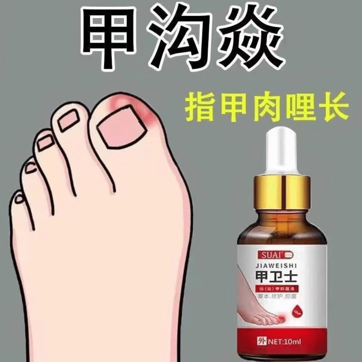 【甲沟焱专用液】B去肉芽脚趾甲往肉里长红肿疼痛流脓嵌甲抑菌液