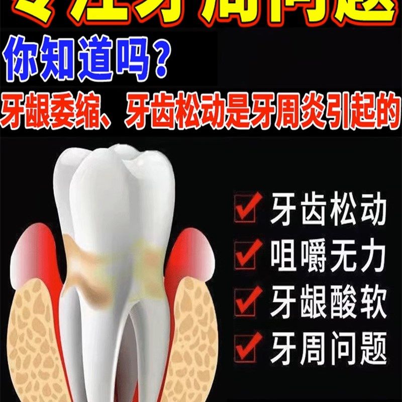 极速【比c打钉还牢固】牙齿松动牙膏修复固齿牙龈委缩肿痛晃动专,个人护理/保健/按摩器材,电子口腔喷雾器,淘宝优惠券,粉丝福利购,淘宝优惠卷
