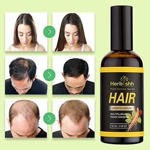 极速Herbishh Hair Growth Vitalizer Serum  AntiQ Hair Loss  T
