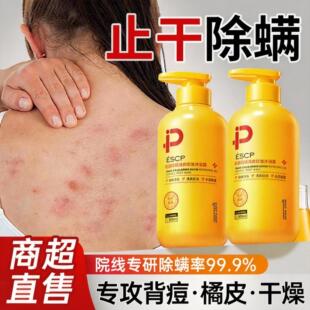 硫磺除螨沐浴露皮肤瘙痒后背净螨祛痘水杨酸持久留香皮肤保湿止痒