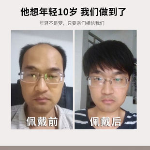 极速假发男短发真发隐形帅气韩版全真发丝男士假发片补Y头顶补发