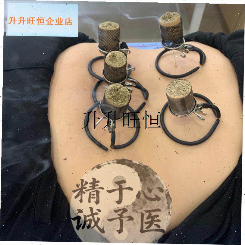 针灸防落灰器温针灸无烟艾灸器温针灸针灸O器温针灸防烫工具艾灸,