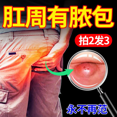 肛周脓肿特效药物肛瘘克星药膏