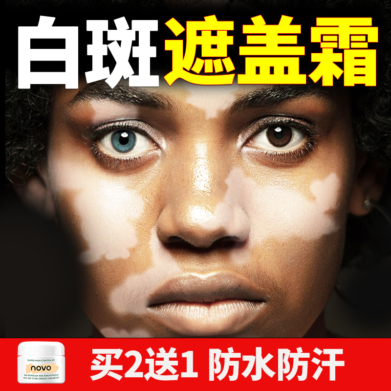 白癜风遮瑕膏皮肤白斑花斑癣汗斑遮盖霜防水汗纹身胎记专用神器