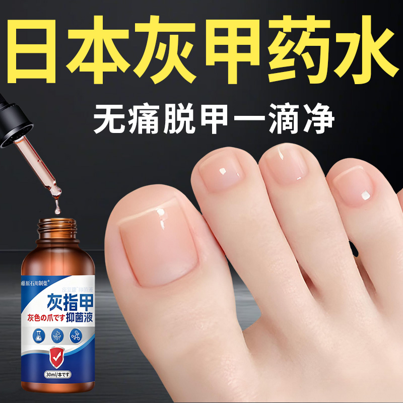 日本灰指甲抑菌液真菌感染