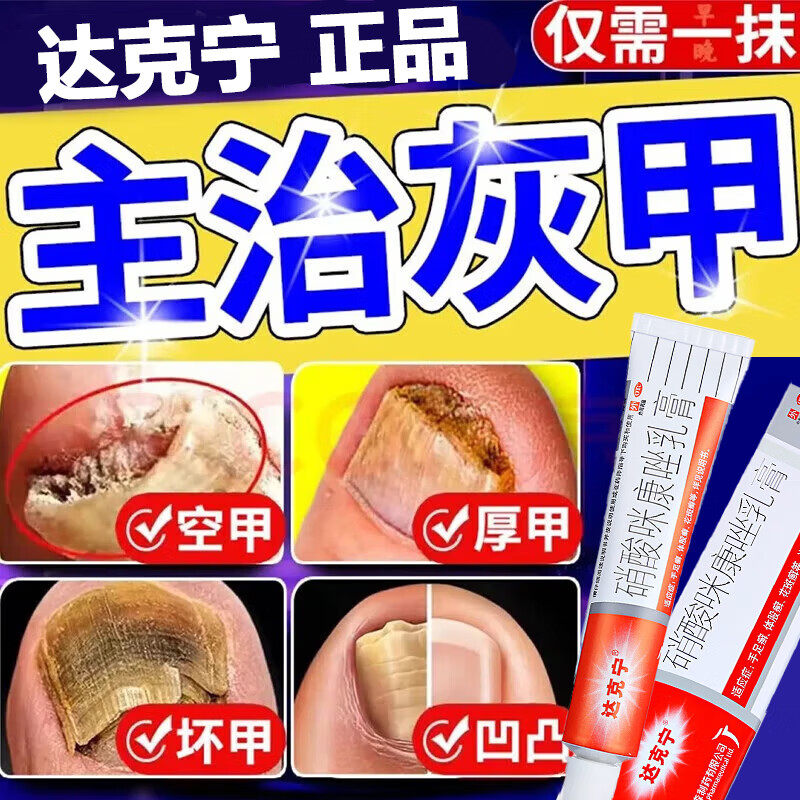 灰指甲特专效药根能治第看一名疗灰指甲专用药正品旗舰店真菌感染
