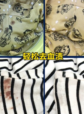 蛋白去渍剂除血渍奶渍蛋渍汗渍肉汁渍蛋白质类污渍血渍清