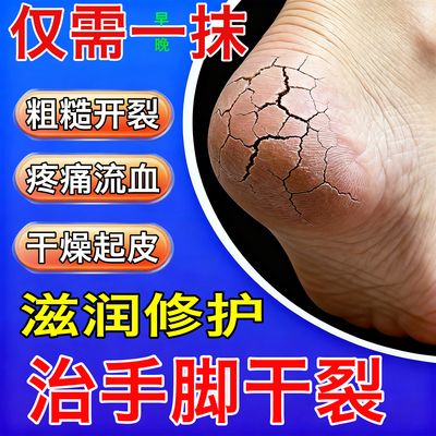 尿素维e乳膏正品软官方旗舰店医用生素防裂手足干皴专治脚开福元