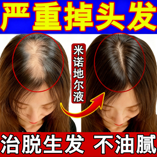 米诺地尔生发液搽剂男士女士斑秃鬼剃头药官方旗舰店脱发非特效QF