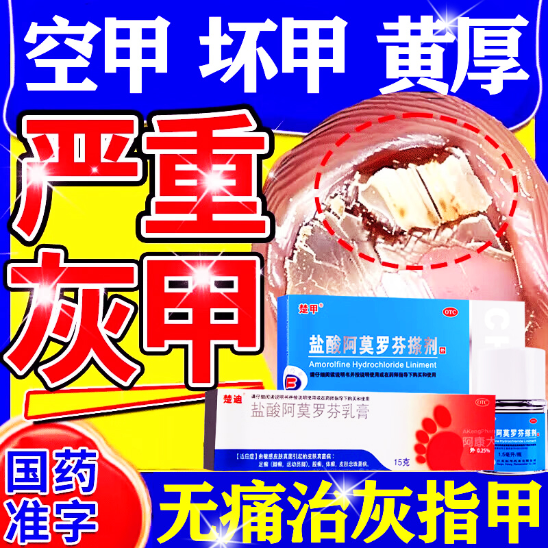 【楚甲】盐酸阿莫罗芬搽剂5%*1.5ml*1瓶/盒
