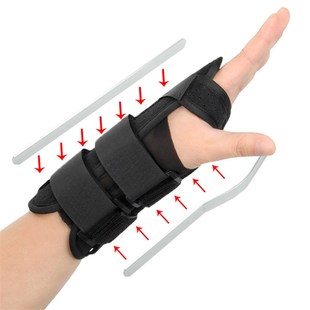 手腕骨折固定器关节扭伤脱位尺桡骨远端夹板腕管腱鞘前臂康复支具