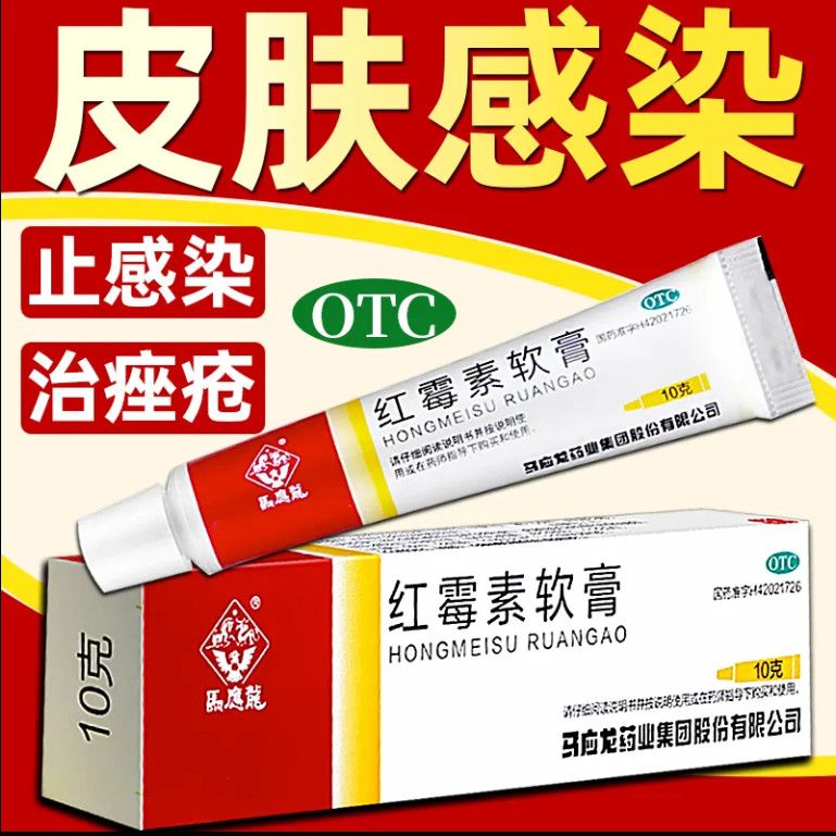 马应龙红霉素软膏正品10g治脓疱疮化脓性皮肤溃疡面感染寻常痤疮