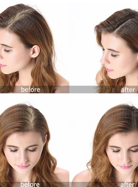 极速2pc PURC Hair Growth Oil Prevent Hair Loss RHair Care fo