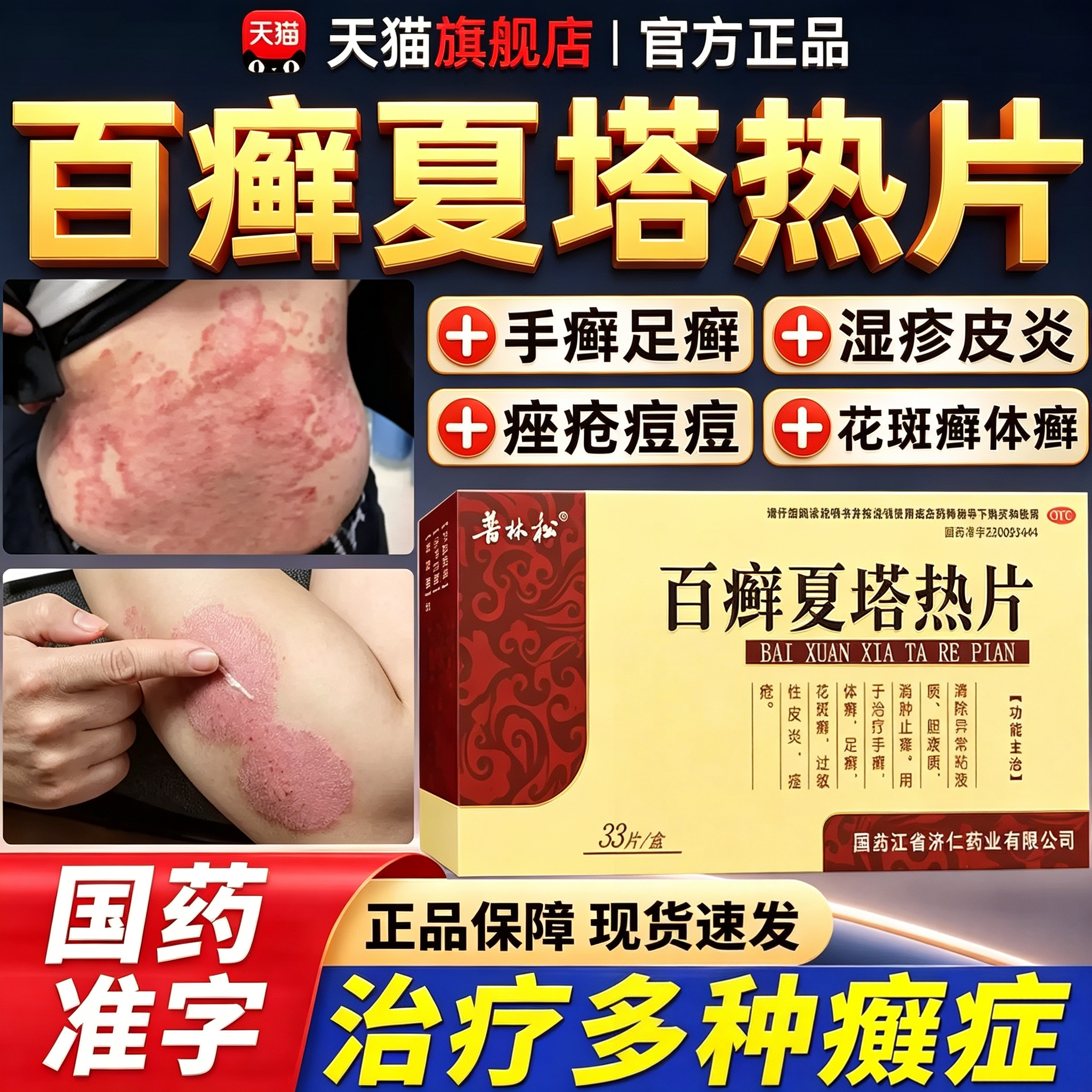 百癣夏塔热片正品止痒胶囊治疗顽固牛皮癣银屑专用药官方旗舰店st