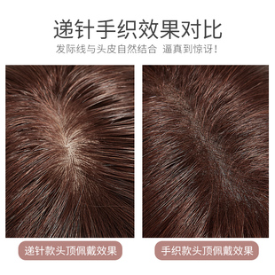 头顶补发片女遮白发轻薄无痕增发神器真发发块发盖局部假发片卷发