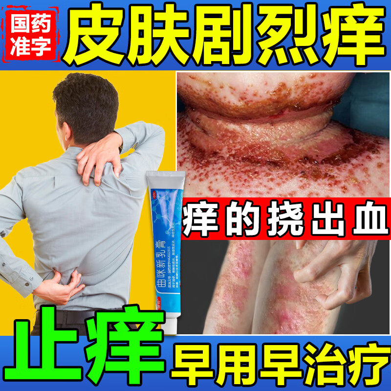 【诺舒】曲咪新乳膏20g*1支/盒