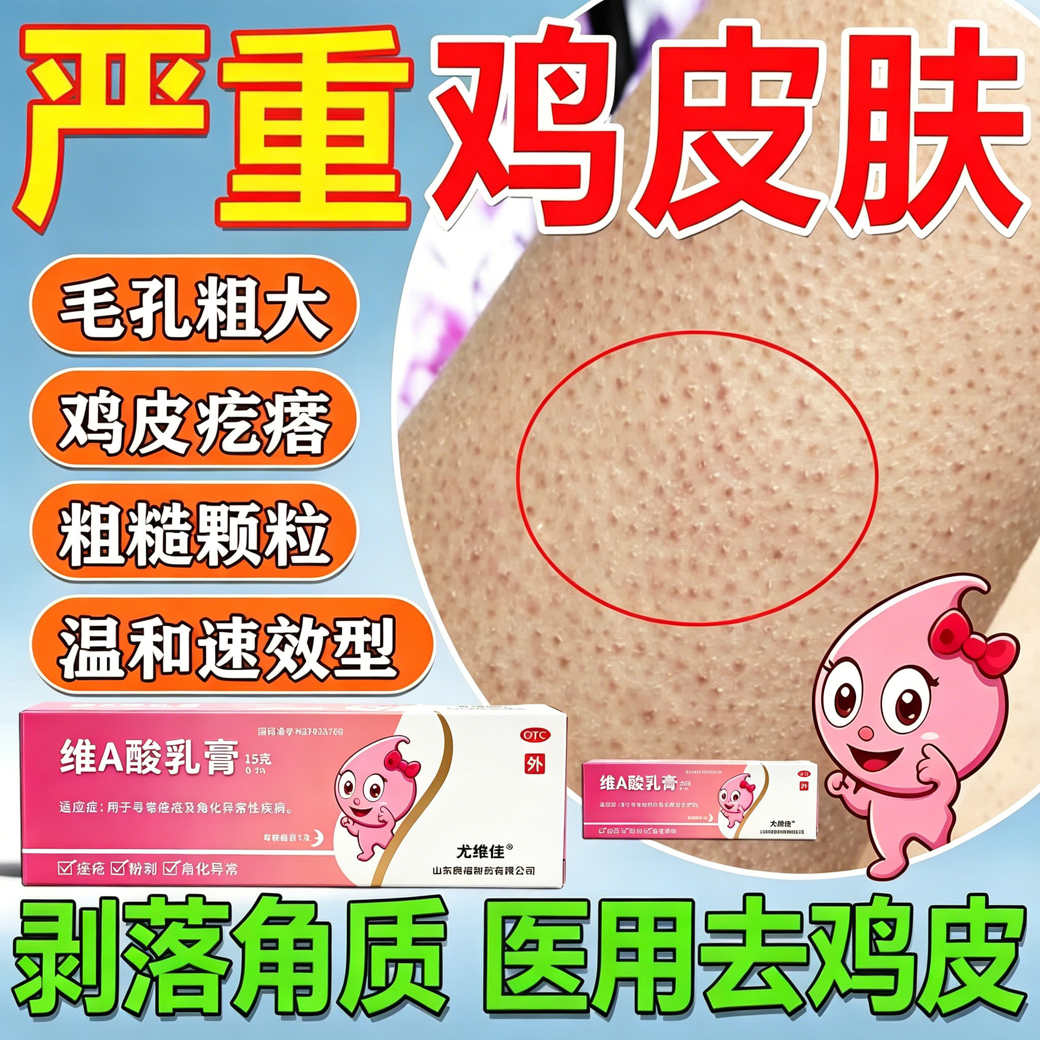 鸡皮肤疙瘩毛囊角化药膏去除全身手臂腿 维a酸乳膏医用官方旗舰店