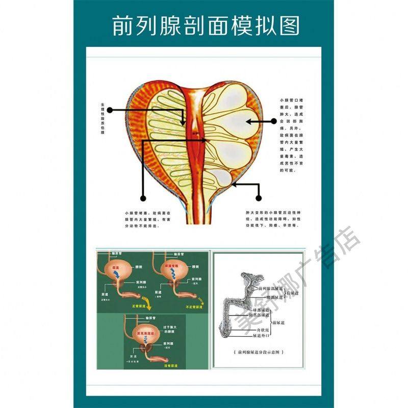 前列腺正中剖面解剖图男性生殖系统海报宣传挂图挂画贴报贴画kt板
