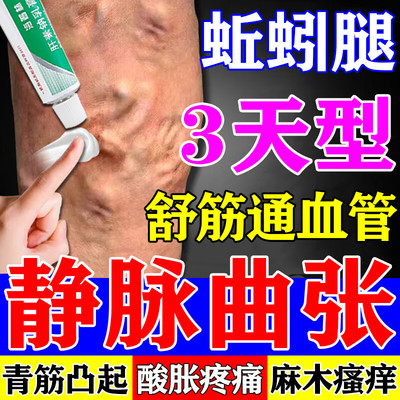 静脉曲张特的效专用药膏青筋凸起红血丝治疗蚯蚓腿血凝胶血管肿胀