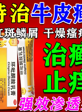 牛皮癣银屑病特药效膏专用官方旗店舰顽固皮肤藓瘙痒红斑鳞屑