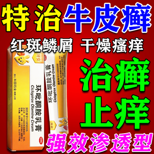牛皮癣银屑病特药效膏专用官方旗店舰顽固皮肤藓瘙痒红斑鳞屑