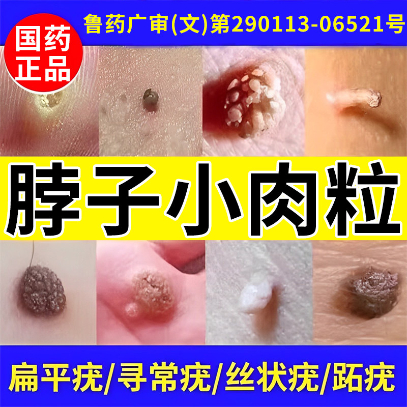 [尤维佳]维A酸乳膏0.1%*15g*1支/盒