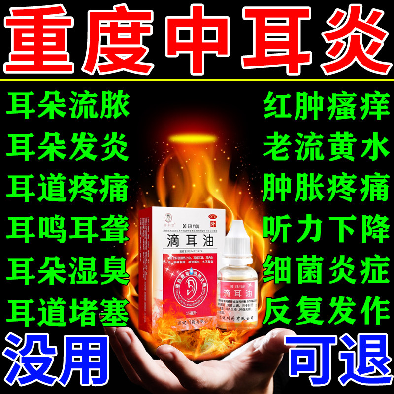 滴耳液中耳炎专用药可除耳根滴耳油治耳道发炎流脓耳朵痒流黄水