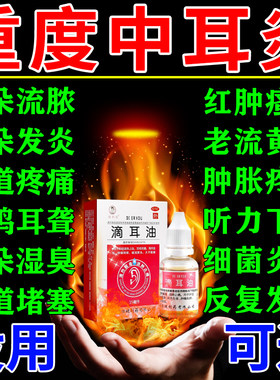 滴耳液中耳炎专用药可除耳根滴耳油治耳道发炎流脓耳朵痒流黄水